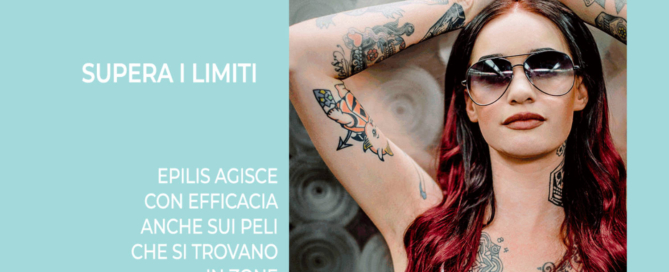 epilazione-permanente-tatuaggi-torino